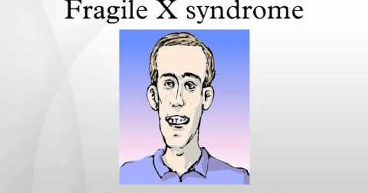 フラジャイルx症候群 Fragile X Syndrome Voicetube 動画で英語を学ぶ