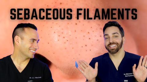 Black Dots on the Nose? Here's How To Treat Sebaceous Filaments