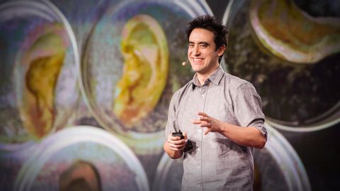 【TED】Andrew Pelling: This scientist makes ears out of apples (This scientist makes ears out of apples | Andrew Pelling)