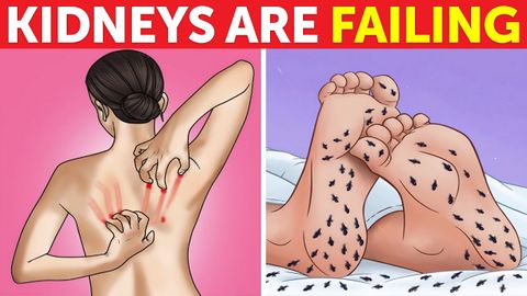 8 STRANGE Signs Your Kidneys Are Crying for Help