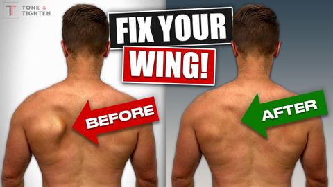 Fix Scapular Winging FOR GOOD! [Shoulder Blade Exercises]