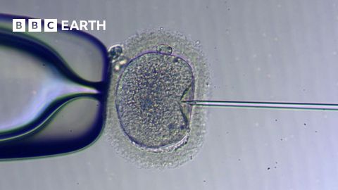 試管嬰兒的原理 | 生育的故事 | BBC 地球科學 (How IVF Works | The Story of Fertility | BBC Earth Science)