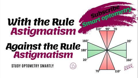 ルールあり＆ルールなし 乱視 (With the rule & Against the rule Astigmatism)