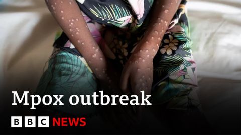 What is mpox and how is it spread? | BBC News