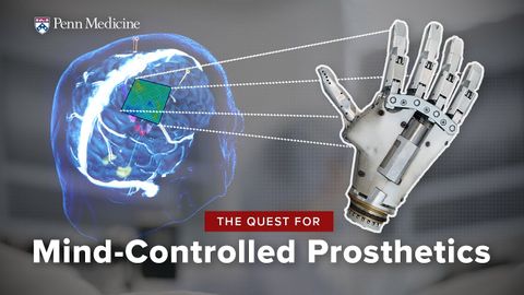 思考制御義肢装具：ブレイン・コンピューター・インターフェイスのブレークスルー (Thought-Controlled Prosthetics: A Brain-Computer Interface Breakthrough)