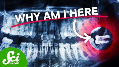 Why Do We (Still) Have Wisdom Teeth?