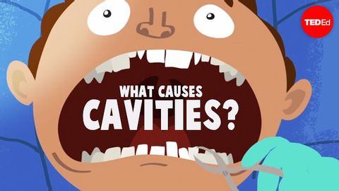 【TED-Ed】為什麼會有蛀牙？(What causes cavities? - Mel Rosenberg)